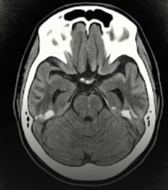 A L F A R D strona autorska T1ak
